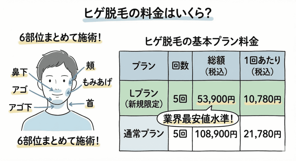 ヒゲ脱毛の料金はいくらなのかのイラスト